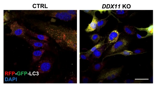La proteina che pulisce le cellule apre nuove speranze nelle malattie neurodegenerative