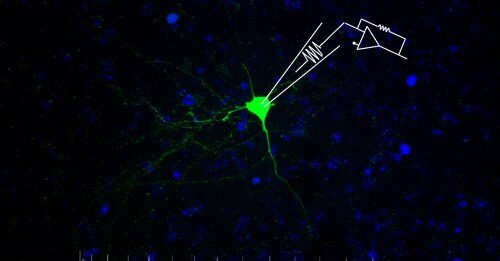 Depressione, scoperto il meccanismo cellulare che riduce l’attività dei neuroni